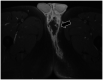 Fig. 11