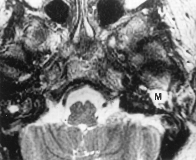 Fig 2.