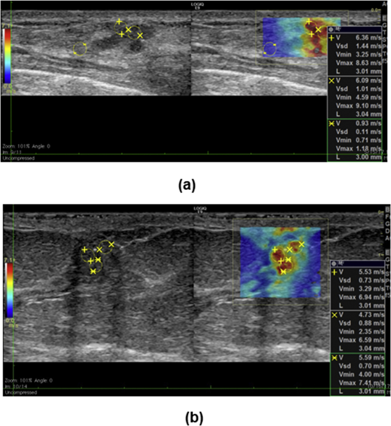 Fig. 4