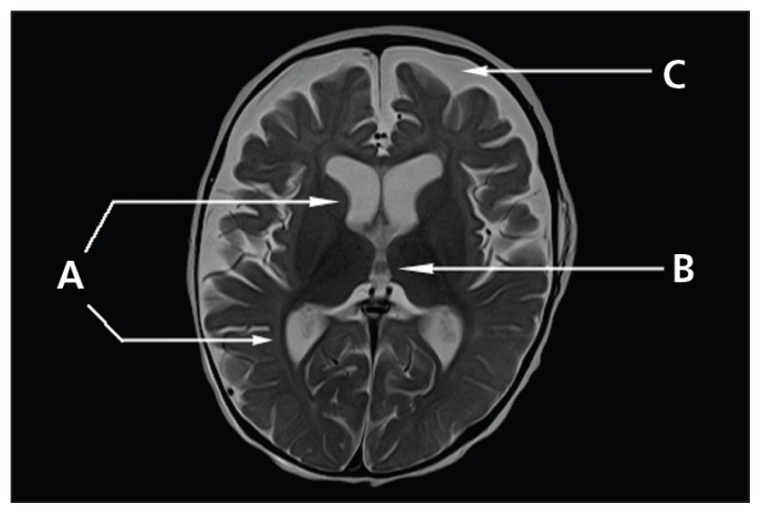 Figure 2: