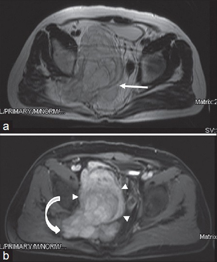 Figure 15