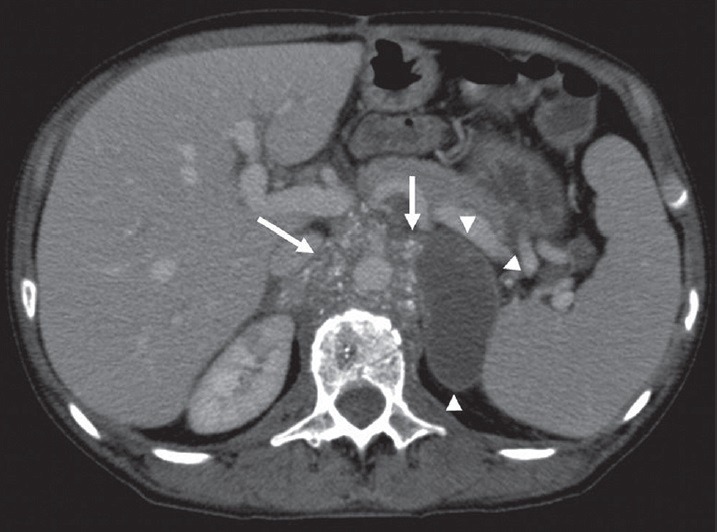 Figure 18