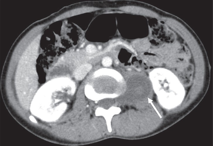 Figure 14
