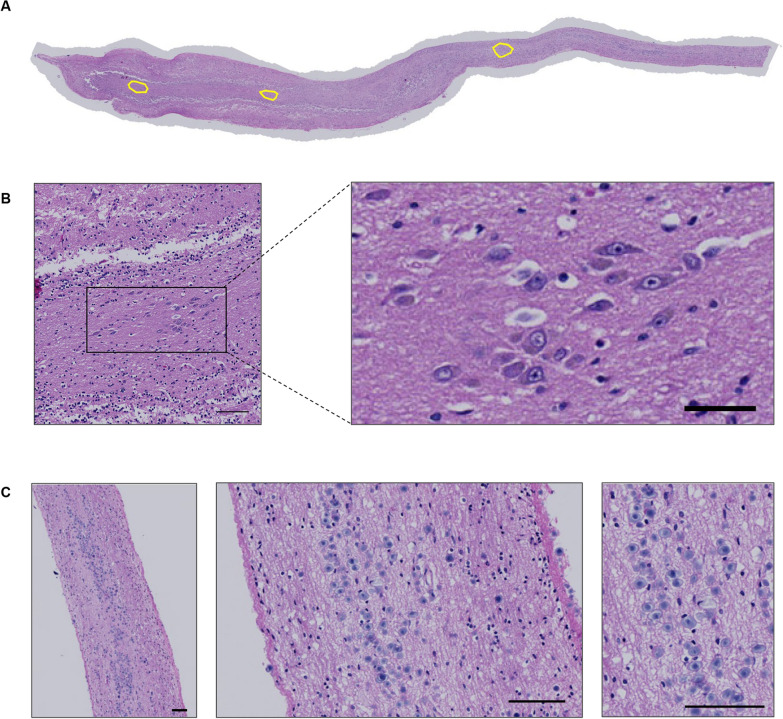 Fig. 1