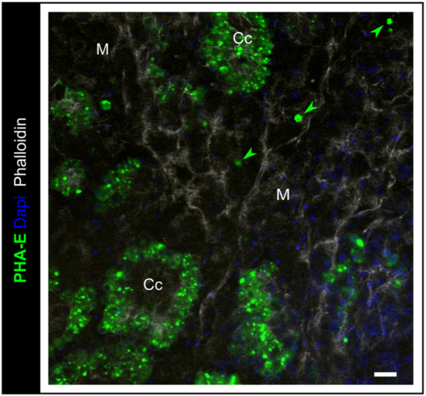 Figure 16