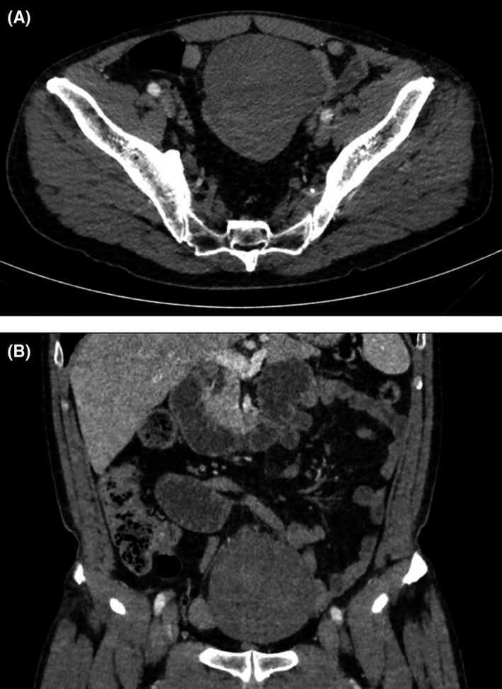 FIGURE 1