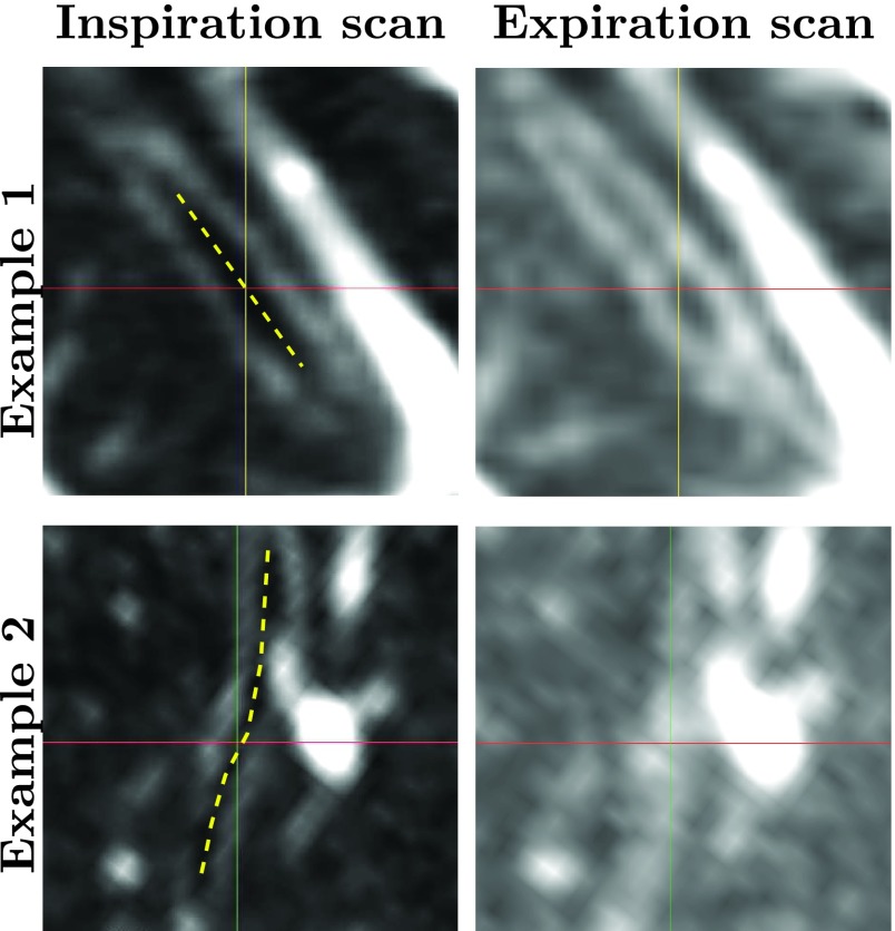 FIG. 2.