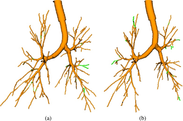 FIG. 15.