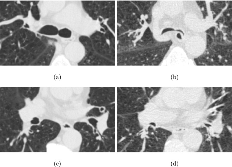 FIG. 17.