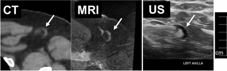 Fig. 11