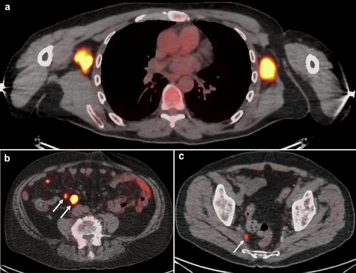 Fig. 13