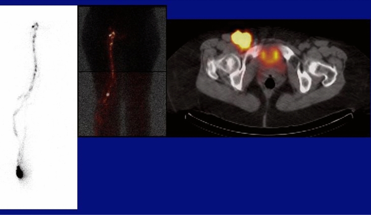 Fig. 14