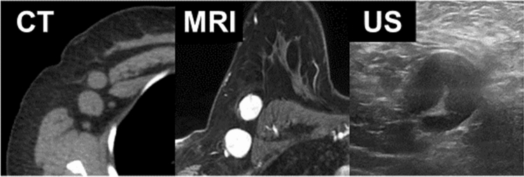 Fig. 12