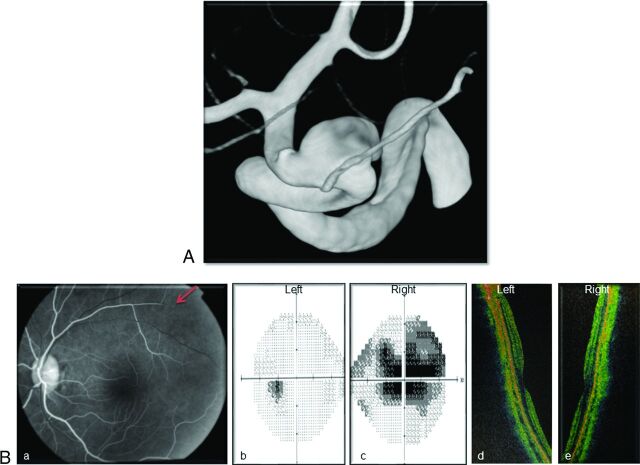 Fig 3.