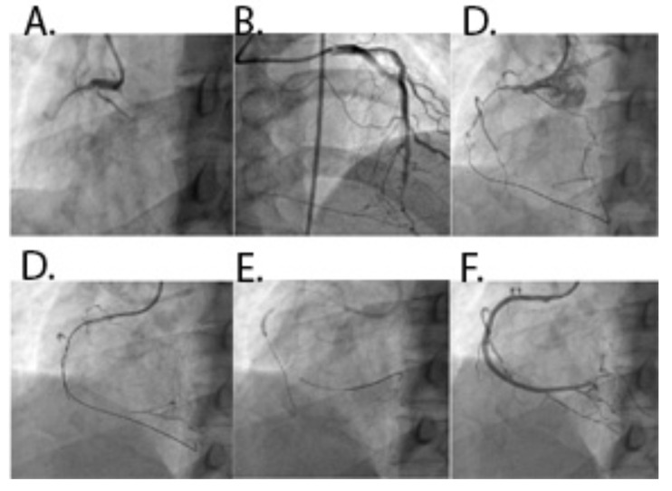 Fig. (5)