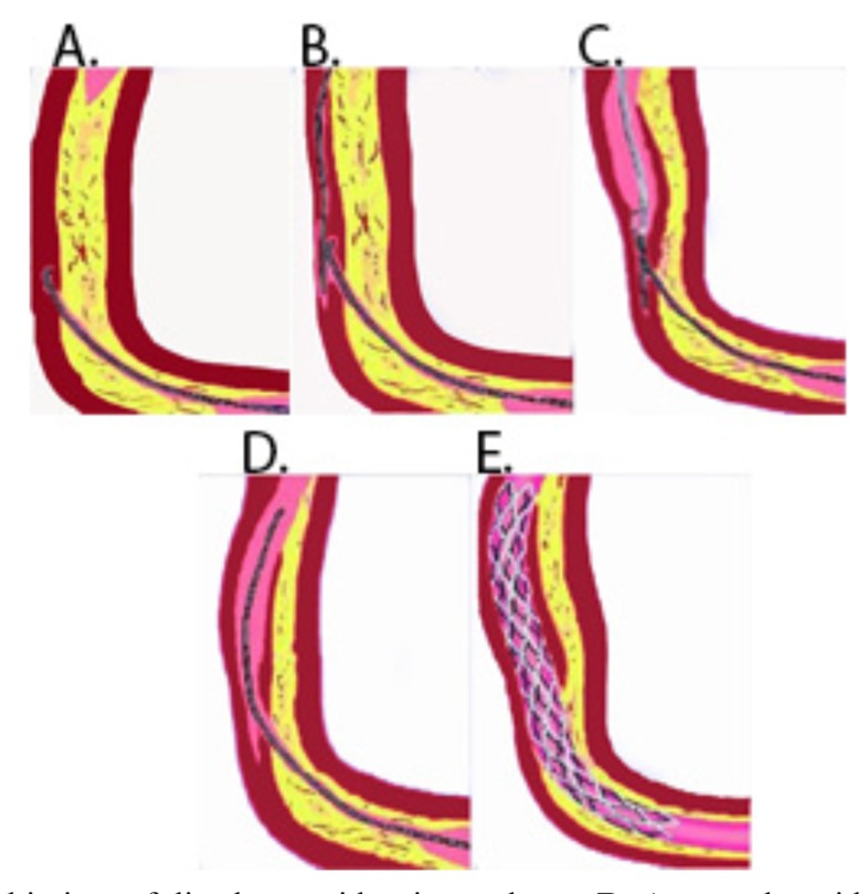 Fig. (7)