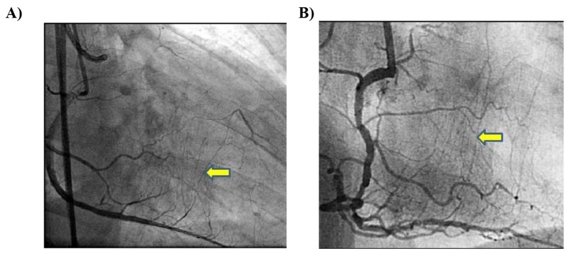 Fig. (1)