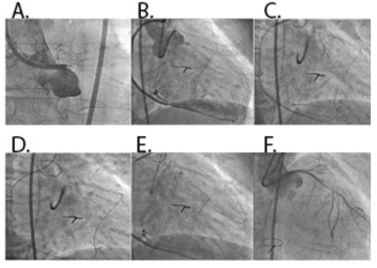 Fig. (3)