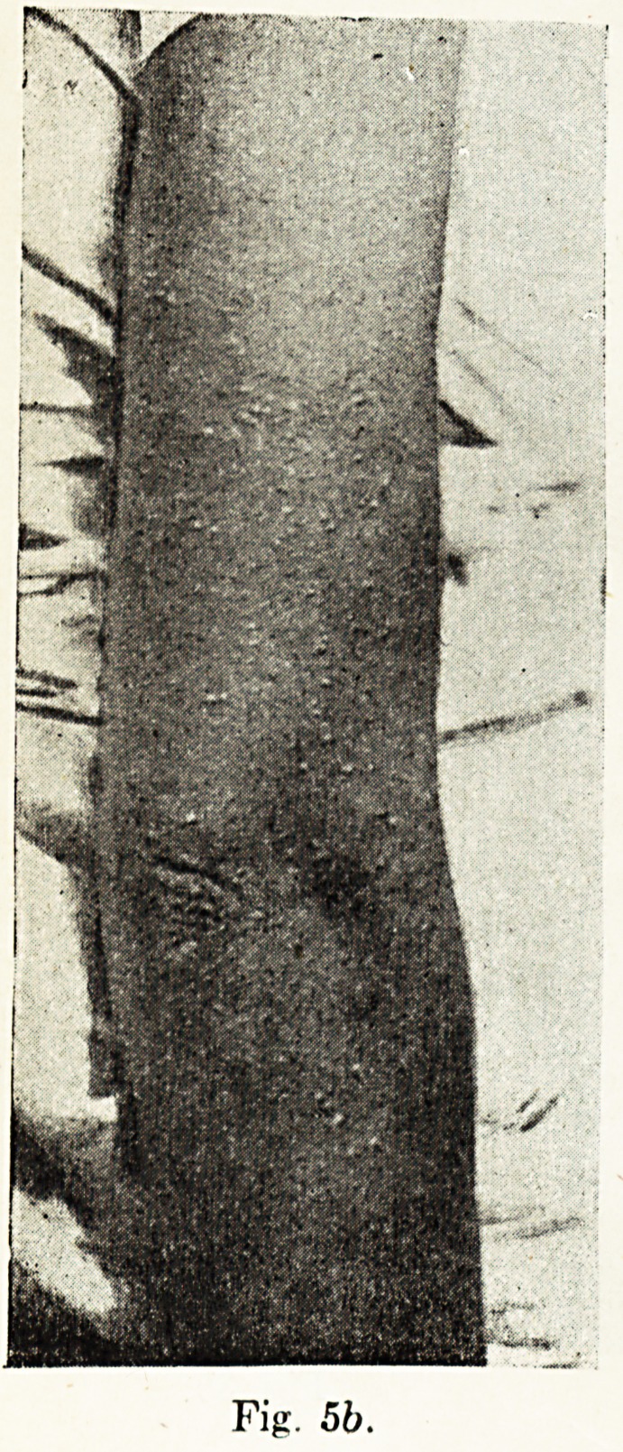 Fig. 5b.