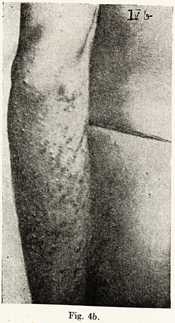 Fig. 4b.