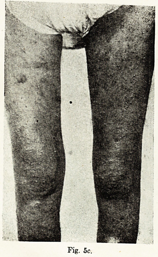 Fig. 5c.