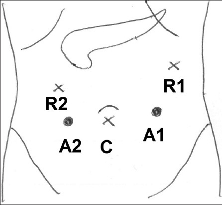 Fig. 1