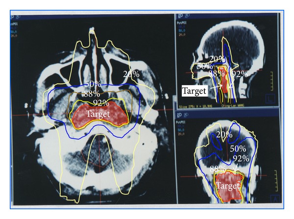 Figure 10