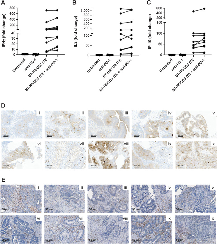 Figure 6. B7-H6/CD3 ITE induces secretion of cytokines in colorectal cancer precision cut tumor slice cultures. A–C, Fresh tumor tissue from 10 patients with colorectal cancer were cultured for 48 hours in a 24-well plate in presence of 15 μg/mL B7-H6/CD3 ITE and/or 10 μg/mL anti-PD-1 or medium alone (untreated). IL2, IFNγ, and IP-10 were quantified in the cell culture supernatant. Each datapoint represents one tumor sample. B7-H6 (D) and CD3 (E) expression in 10 colorectal cancer tissue samples at baseline.