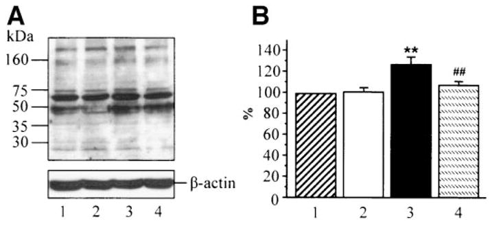 FIG. 5