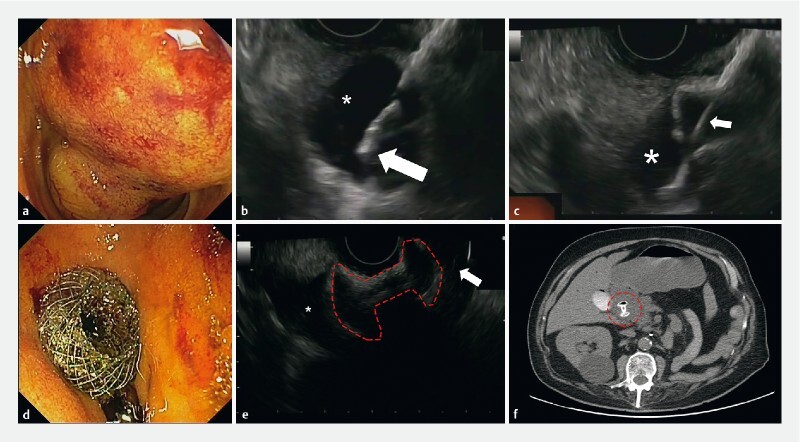 Fig. 1