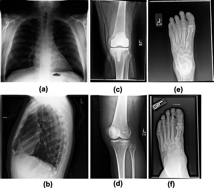 Fig. 1