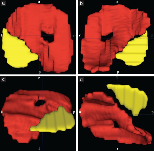 UOG-20296-FIG-0004-c