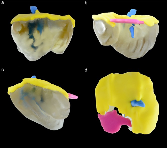 UOG-20296-FIG-0008-c