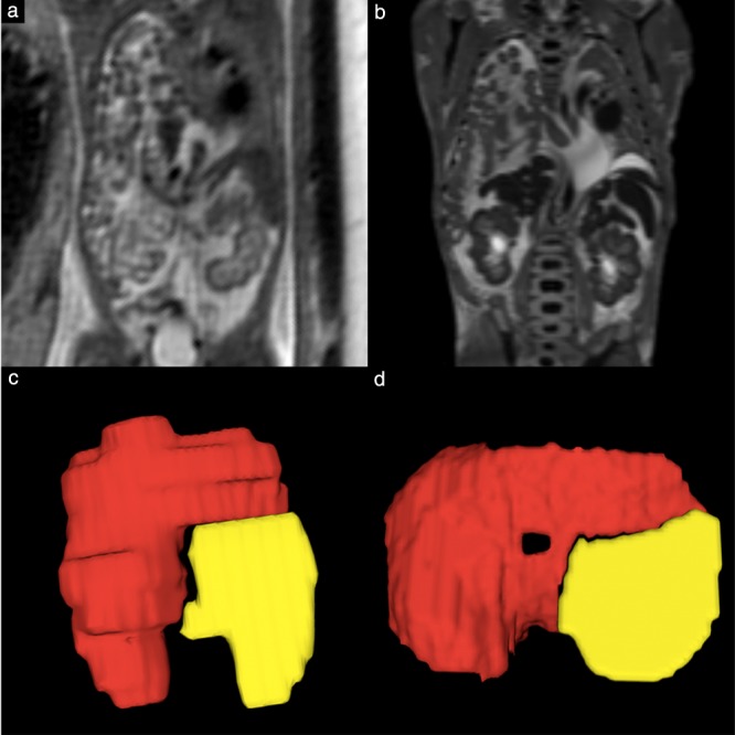 UOG-20296-FIG-0007-c