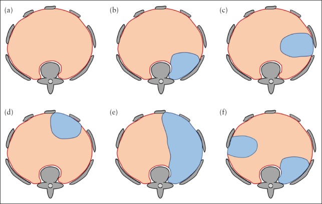 UOG-20296-FIG-0005-c