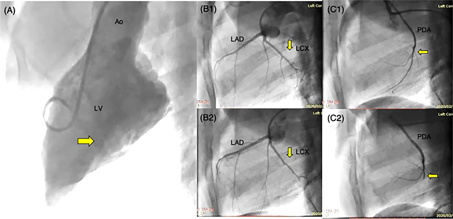 Fig. 3