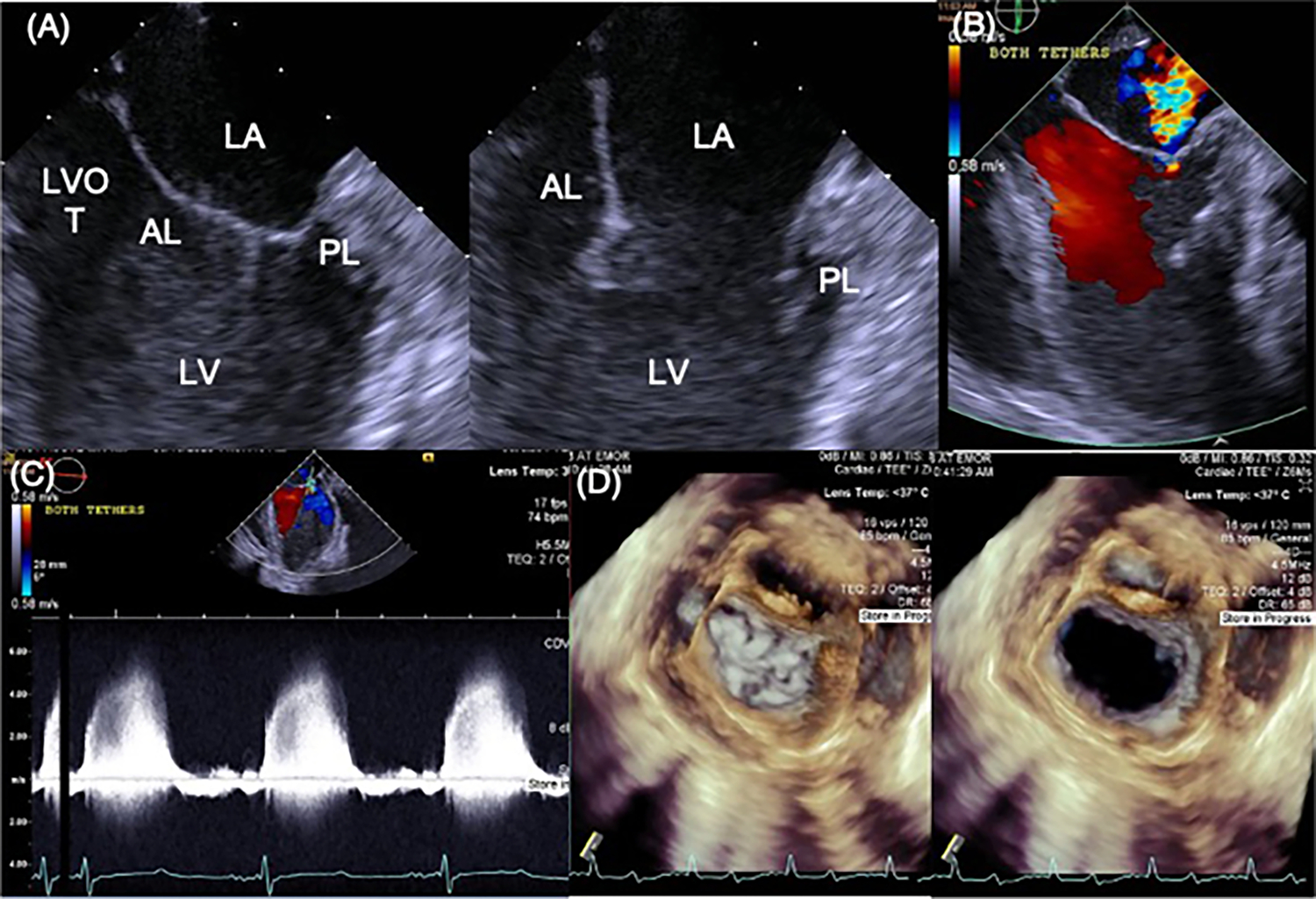 Fig. 4