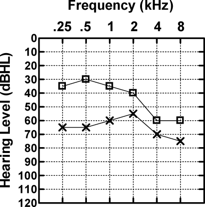 FIG. 1