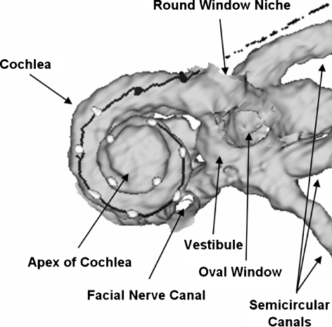 FIG. 3