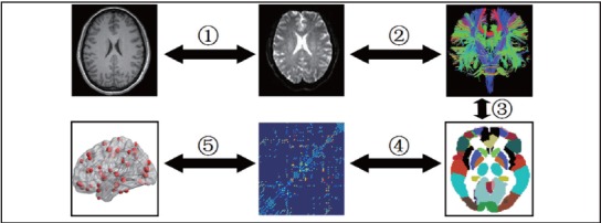 The weighted brain WM structural network for each participant is constructed using the following steps: (1) The T1-weighted image is registered a) to the corresponding baseline non-diffusion-weighted (b=0) image using a linear transformation and b) to the standard FA template in the Montreal Neurological Institute (MNI) 152 standard space (MNI-152 space) using the FSL non-linear transformation. Using the transformation matrices created in these two register processing steps, the resulting transformation matrix from diffusion space to MNI space is calculated and stored for later use. (2) The white matter fiber bundles in the whole brain are defined by using DTI deterministic tractography with a Diffusion toolkit (<ext-link ext-link-type="uri" xlink:href="http://www.trackvis.org">http://www.trackvis.org</ext-link>) to generate the three-dimensional curves characterizing cortical fiber tract connectivity and to reconstruct white matter tracts of the brain network based on the diffusion map. (3) An automated anatomical labeling (AAL) template is used to parcellate the brain into 90 cortical regions (45 for each hemisphere), in which each cortical or subcortical region represents a node of the cortical network. (4) The resulting weighted matrix is constructed by calculating the mean FA values of the connected streamlines between regions by the average of FA values of all voxels on each fiber track as the weights of the network edges. (5) The weighted brain WM structural network is constructed for each participant.