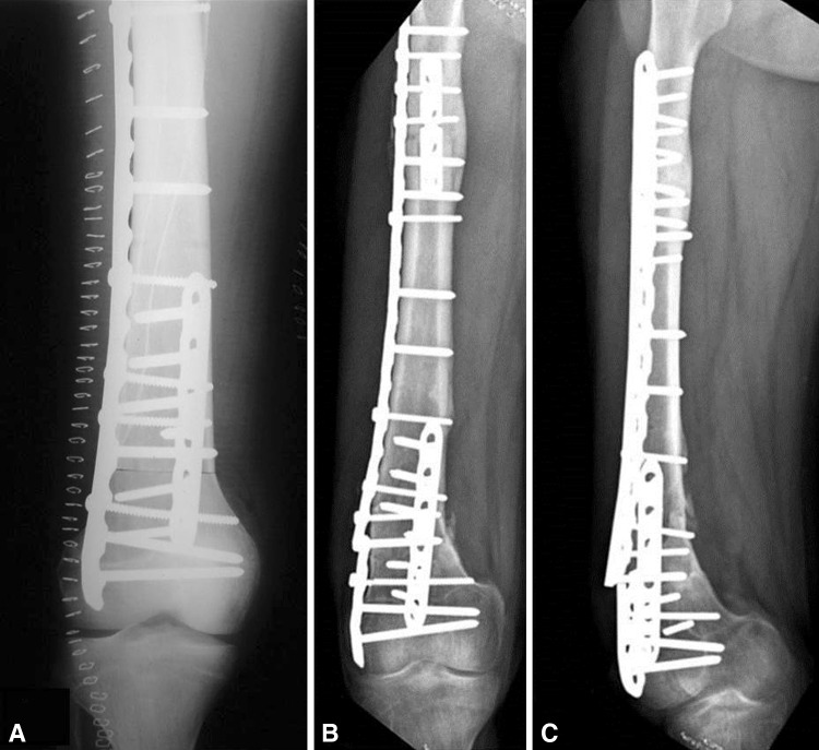 Fig. 1A–C