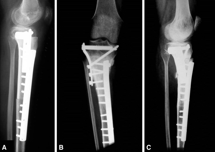 Fig. 3A–C