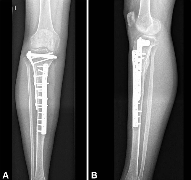 Fig. 4A–B