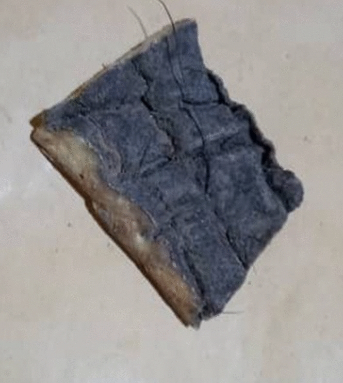 Fig. 5