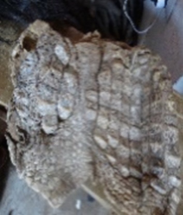 Fig. 3