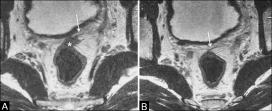 Figure 13 (A and B)