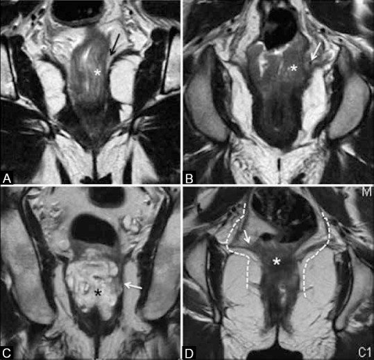 Figure 18