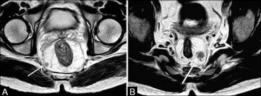 Figure 15 (A and B)