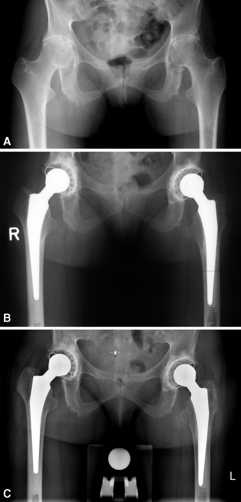 Fig. 3A–C