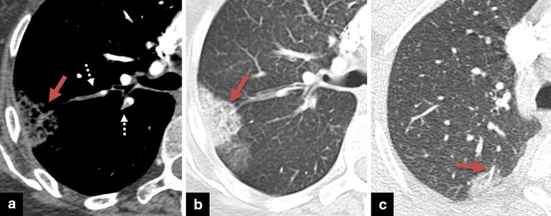 Fig. 14